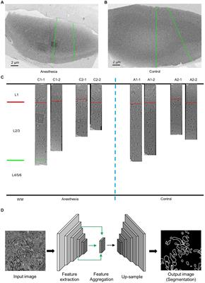 Clinical concentration of sevoflurane had no short-term effect on the myelin sheath in prefrontal cortex of aged marmosets